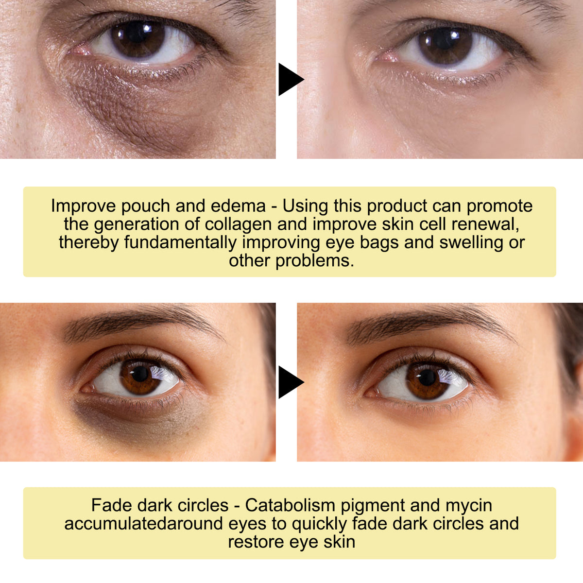 Gold Snail Collagen Eye Mask – 24K Gold & Snail Filtrate Hydrating Patches